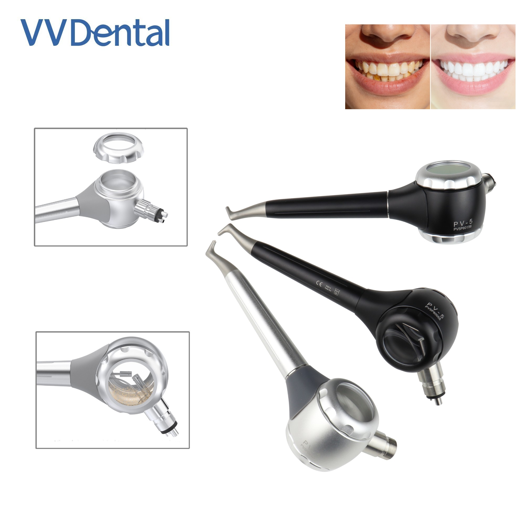 Teeth Whitening Free - VV 치과용 2/4홀 치아 미백 샌드블라스팅