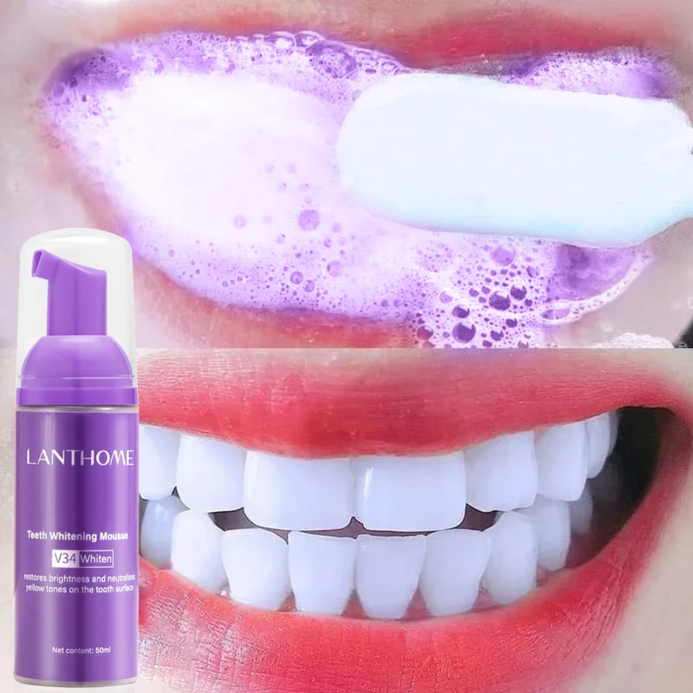 Teeth Whitening Crest - 무스 V34 치아 세척 효과적인 미백