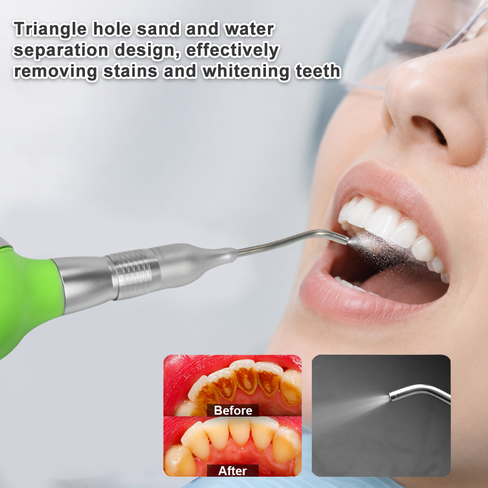 역류 방지 장치가 있는 치과용 에어폴리셔 2홀 및 4홀 - Teeth Whitening Options 리뷰 및 가격