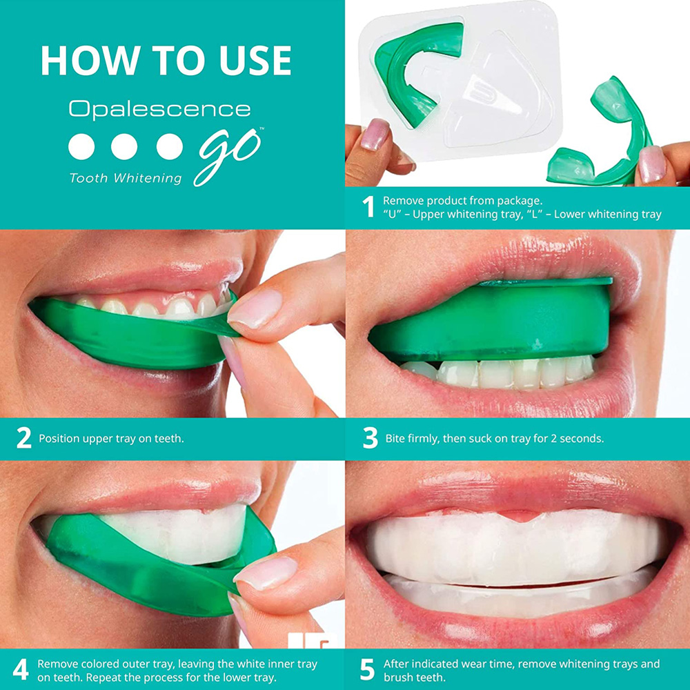 치아 미백용 과산화 수소, 유백광 고 프리필 트레이,  - Teeth Whitening With Hydrogen Peroxide 리뷰 및 가격