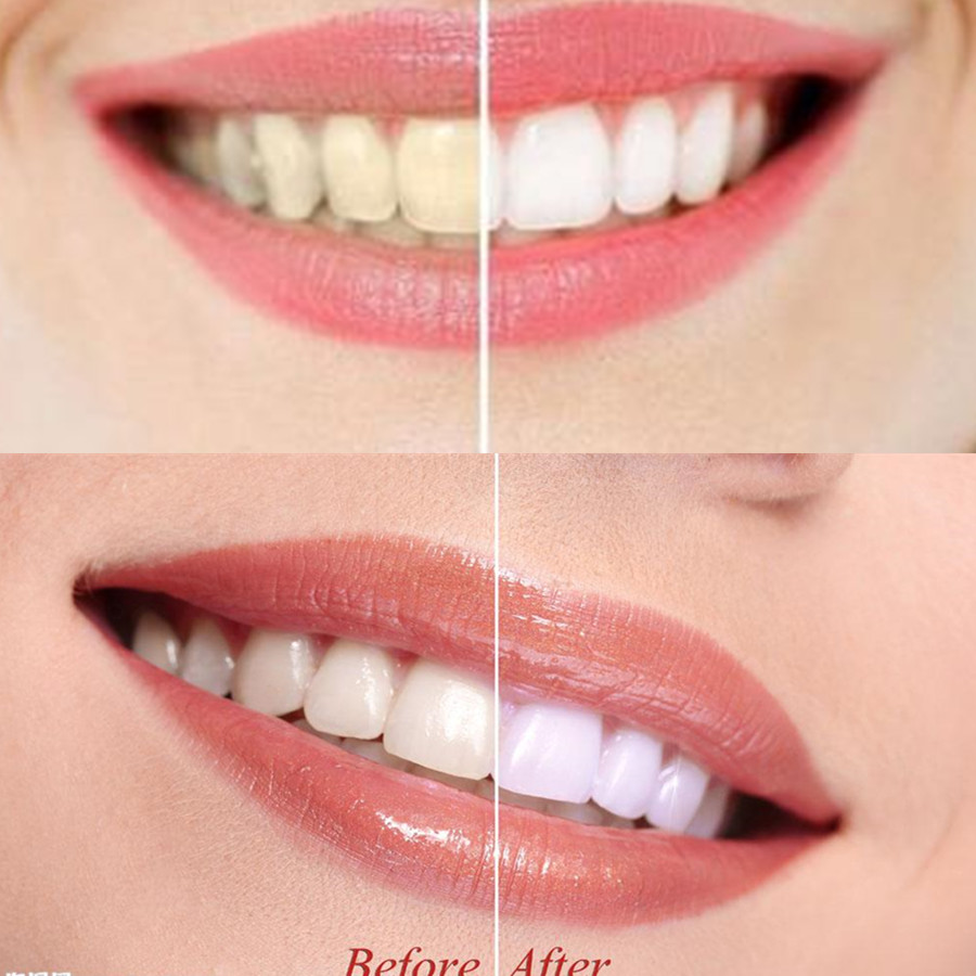 대나무 숯 치아 치아 Dentis Lab 구강 위생 관 - Teeth Whitening China 리뷰 및 가격