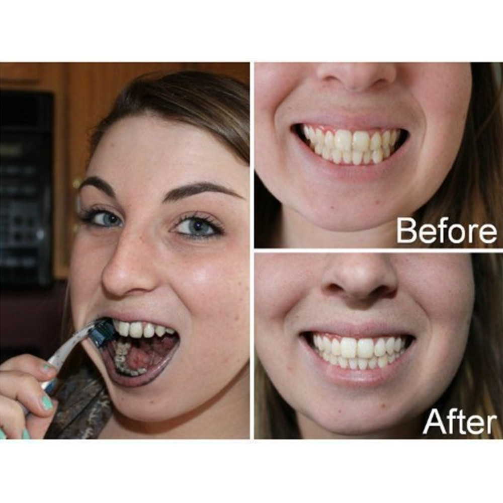 대나무 숯 치아 치아 Dentis Lab 구강 위생 관 - Teeth Whitening China 리뷰 및 가격