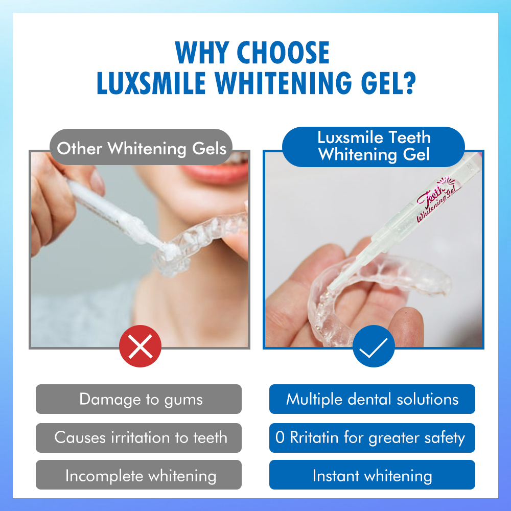 치아 미백 젤 PAP 또는 35%CP 치아 미백 젤 구 - Teeth Whitening At Home 리뷰 및 가격