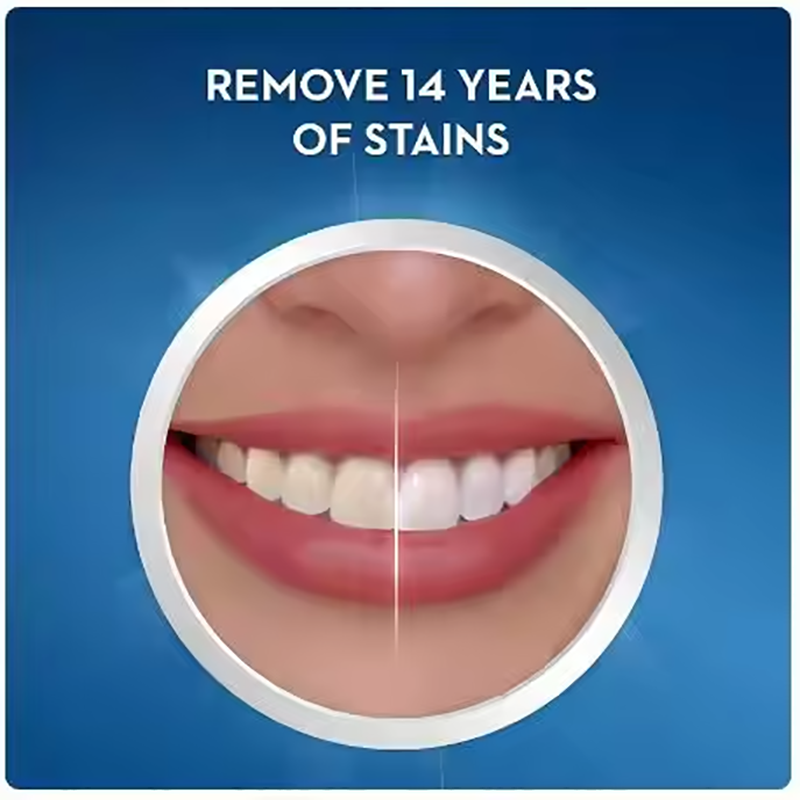 크레스트 화이트 치아 미백 스트립 3D 화이트 전문가  - Teeth Whitening Effects 리뷰 및 가격