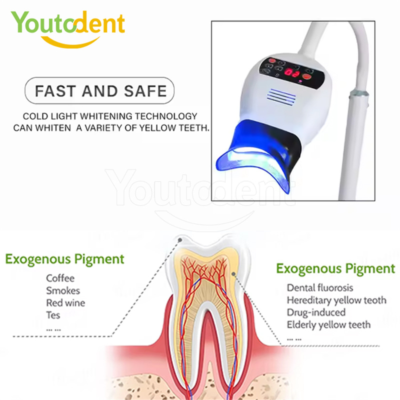 전문 치과용 3색 광 램프 치아 미백기 미백 촉진 장치 - Teeth Whitening Free 리뷰 및 가격