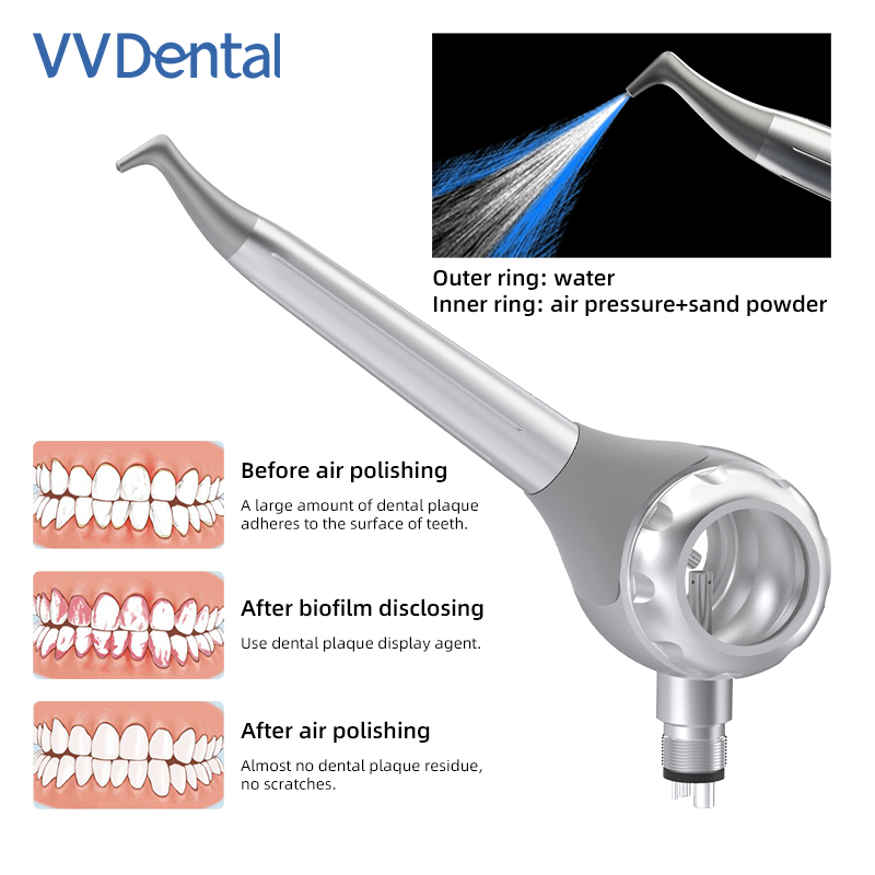 VV 치과용 2/4홀 치아 미백 샌드블라스팅 건 양면  - Teeth Whitening Free 리뷰 및 가격