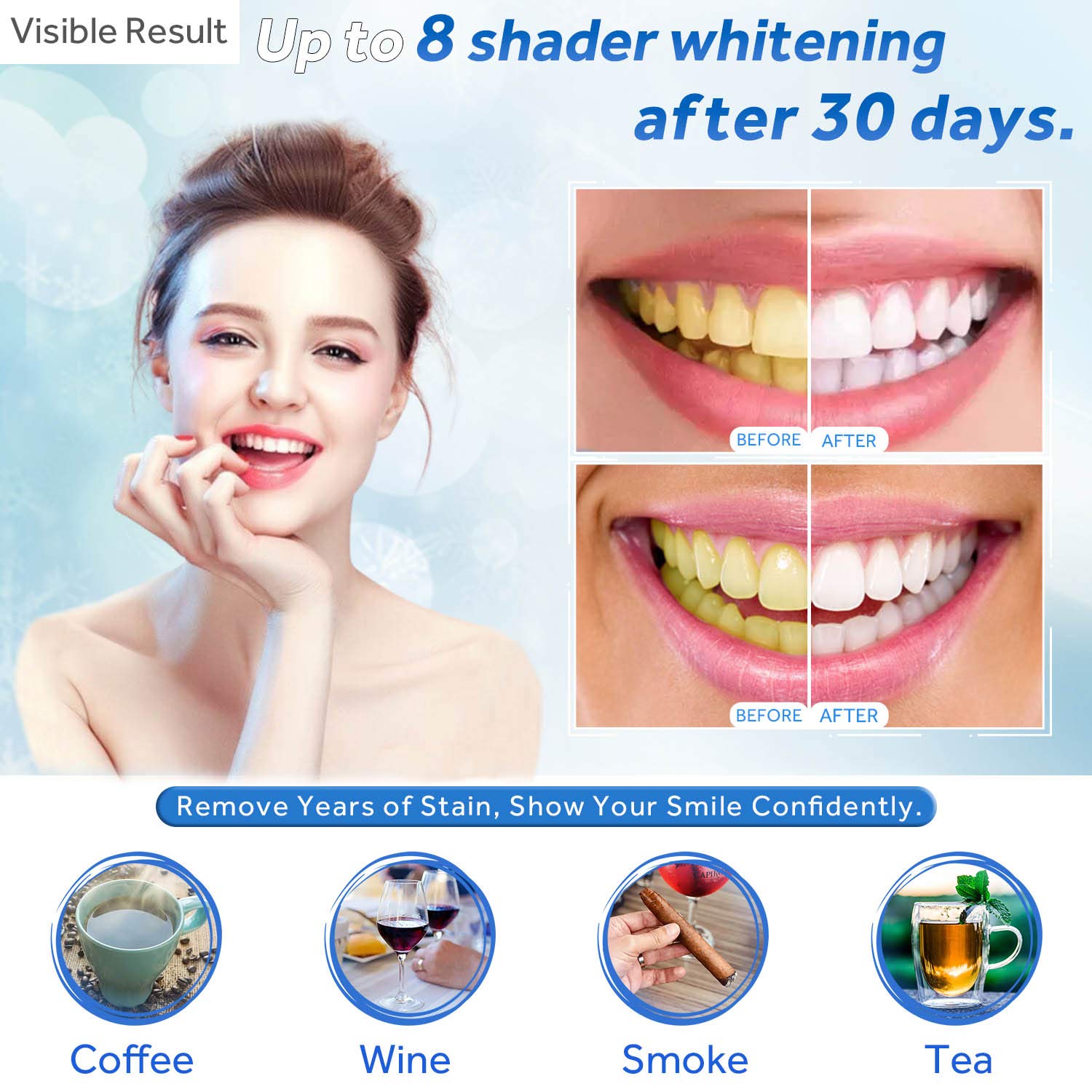 치아 미백 젤 리필 주사기 치아 미백 젤 인비스알라인  - Teeth Whitening At Home 리뷰 및 가격