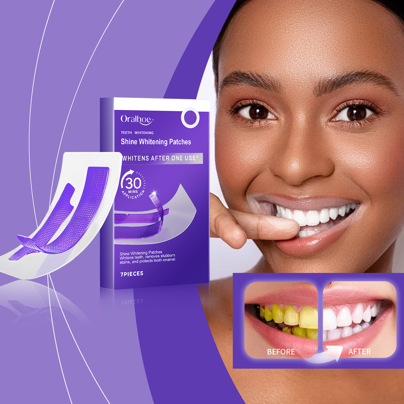 보라색 치아 미백 스트립 – 플라크 및 얼룩 제거, 치 - Teeth Whitening At Home 리뷰 및 가격