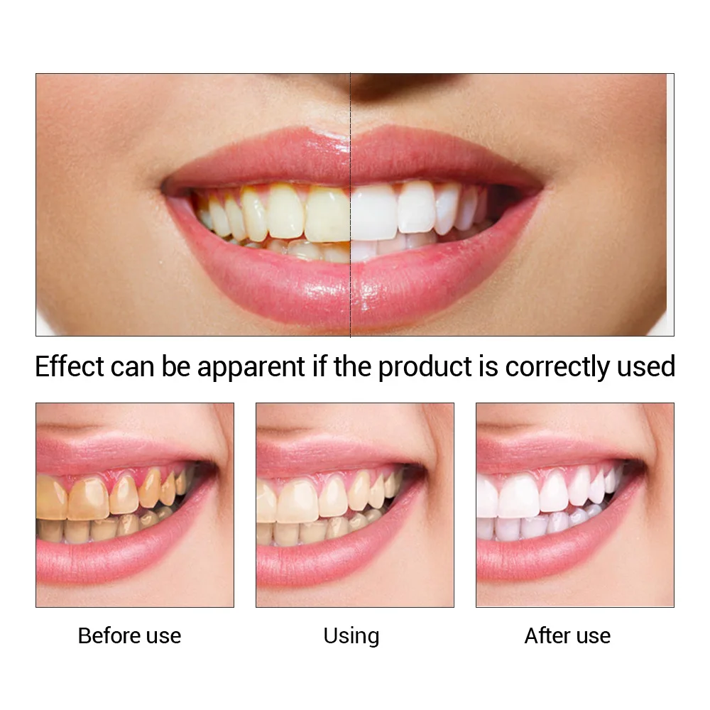 FTEENPLY 치아 미백 에센스 파우더 구강 위생 청 - Teeth Whitening At Home 리뷰 및 가격