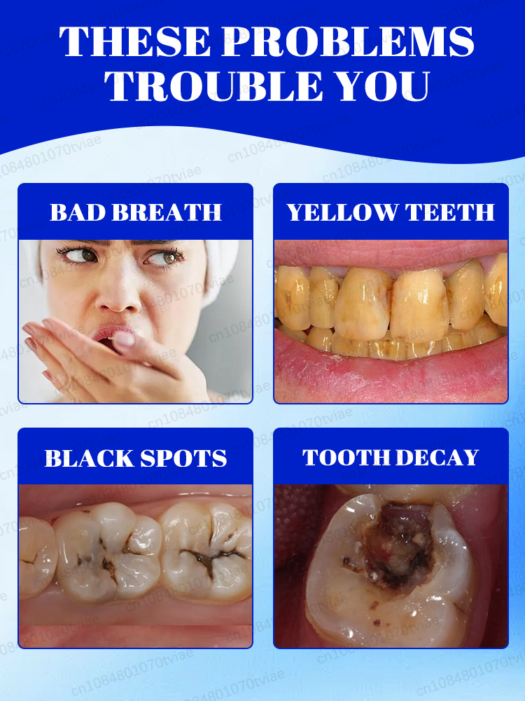 미백 치약과 미네랄 파우더는 치아 미백, 얼룩 제거,  - Teeth Whitening Effects 리뷰 및 가격