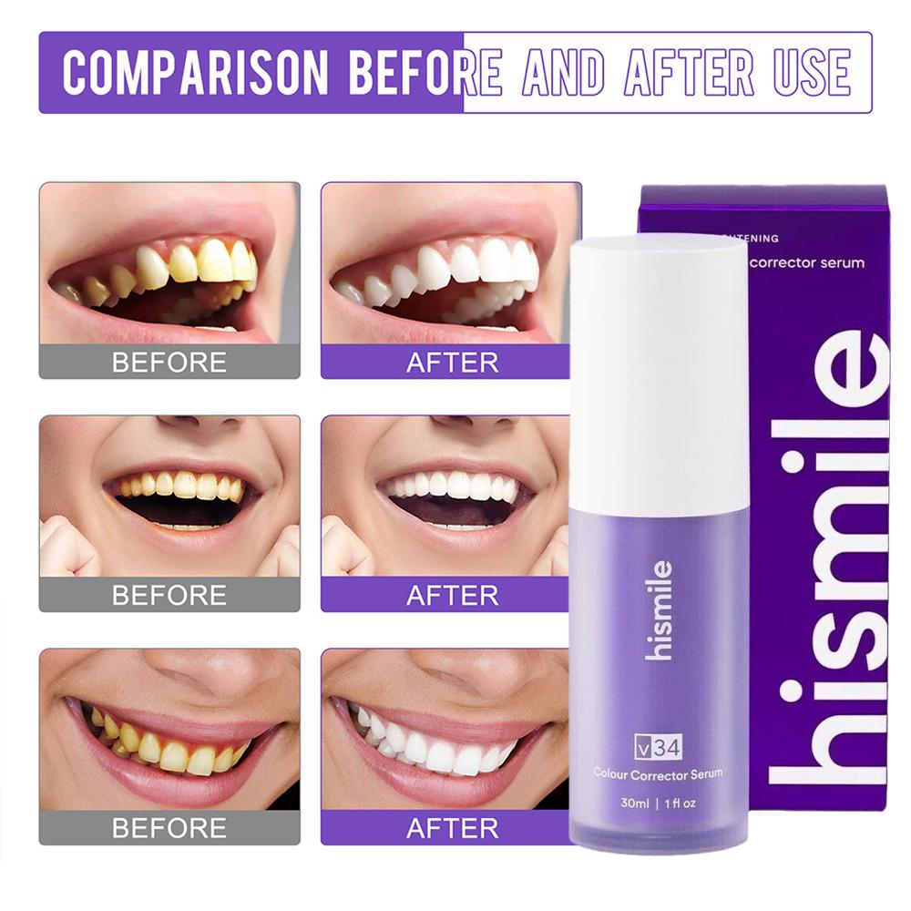    퍼플 V34 히스마일 치아 미백 세럼 컬러 코렉 - Teeth Whitening Crest 리뷰 및 가격
