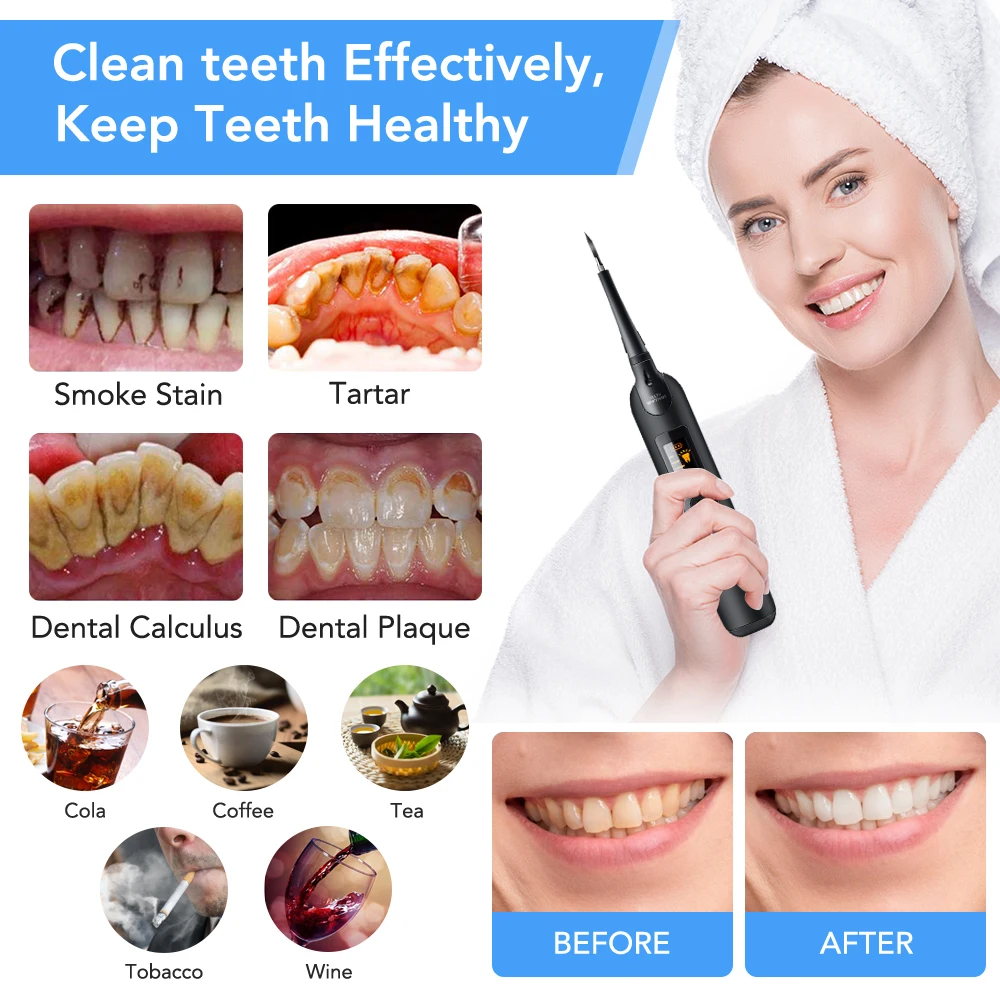 전기 치과 스케일러 칫솔 세트 LCD 화면 LED 라이 - Teeth Whitening Toothbrush 리뷰 및 가격
