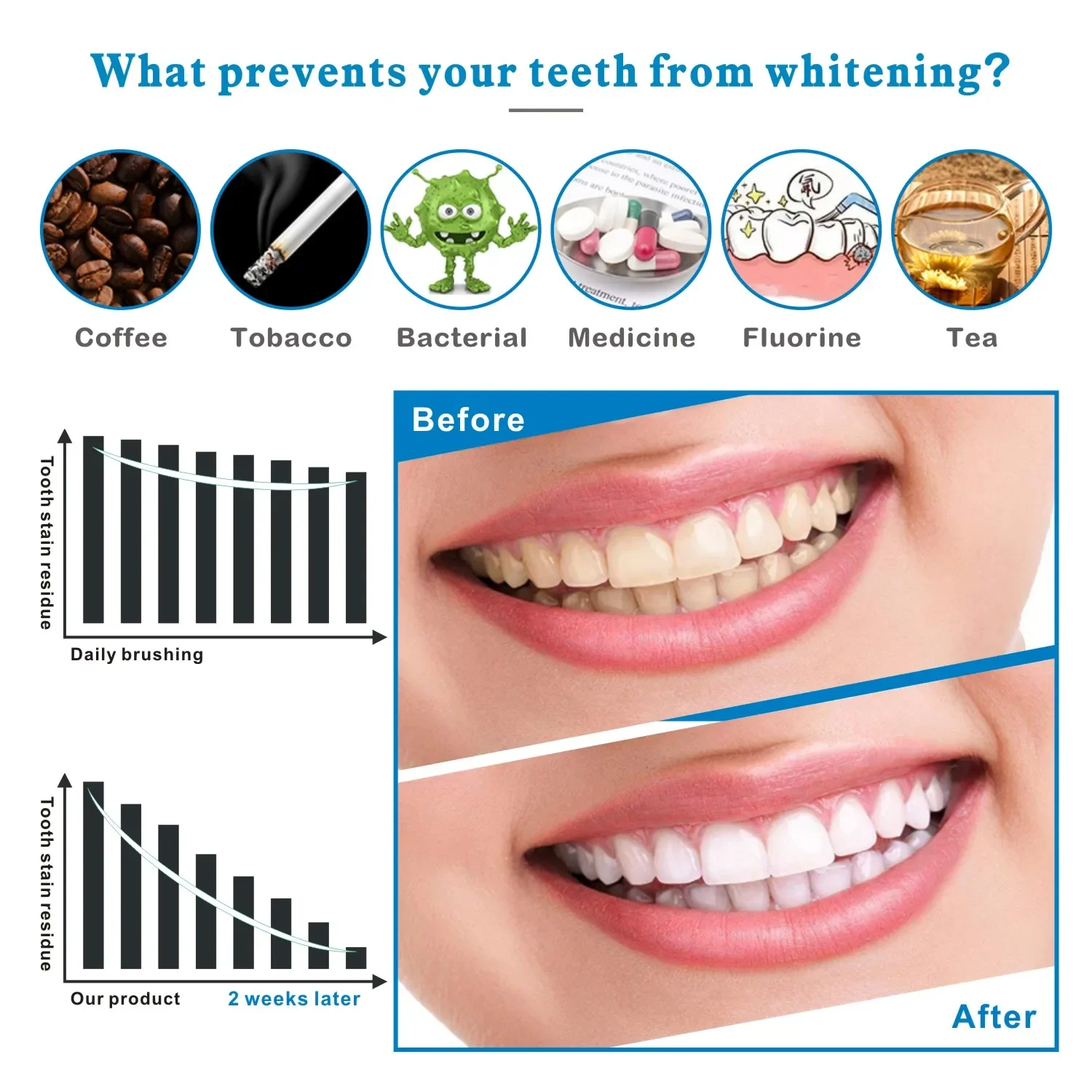 14/28pcs 3D 치아 미백 스트립 Whit 전문  - Teeth Whitening Effects 리뷰 및 가격