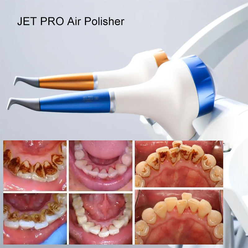 VV 치과용 에어폴리싱 프로피 에어 플로우 구강 위생  - Teeth Whitening Free 리뷰 및 가격