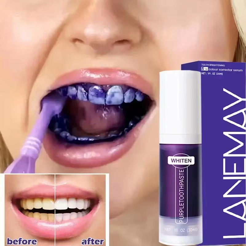 V34 보라색 치아 미백 치약 플라크 얼룩 제거 구강  - Teeth Whitening Crest 리뷰 및 가격