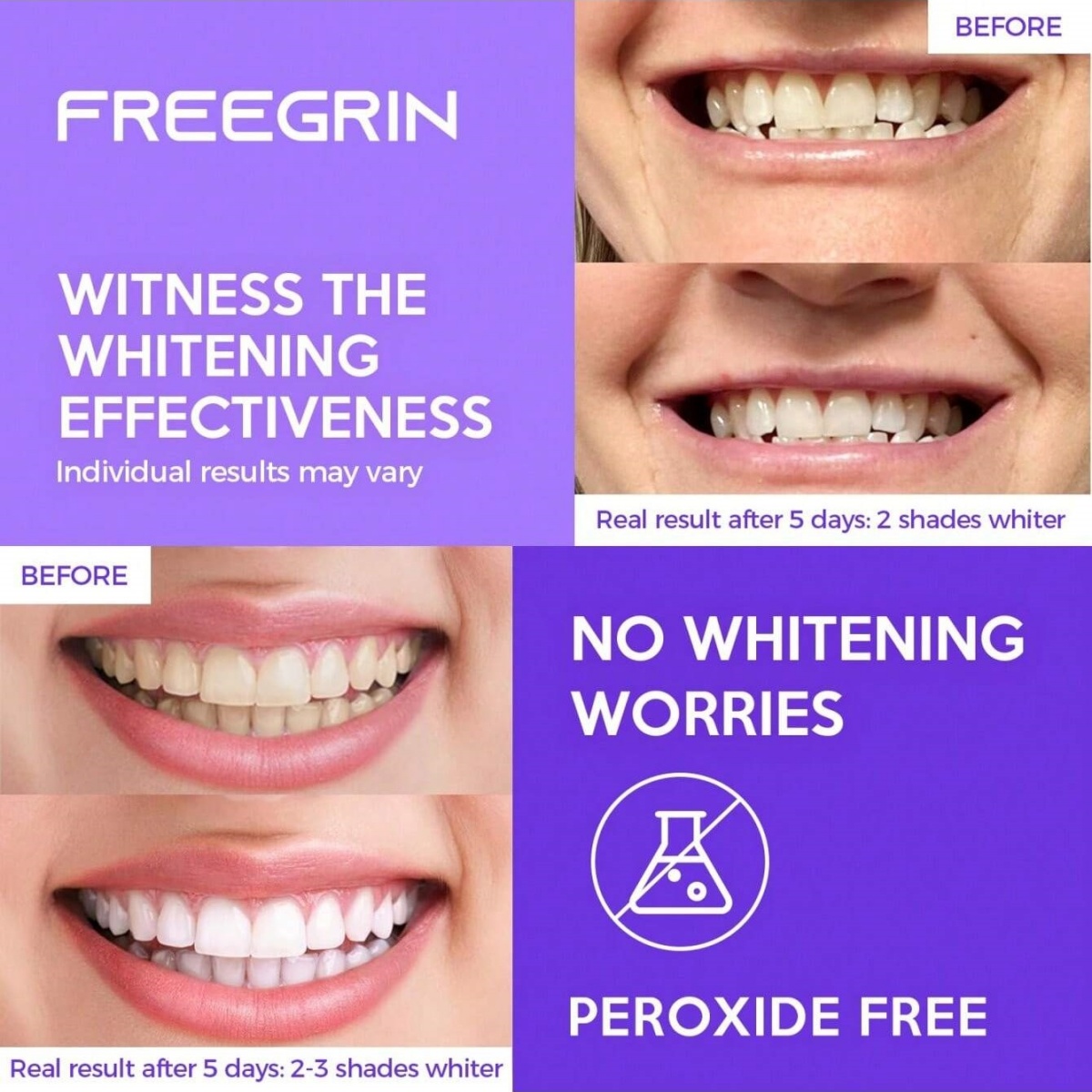 디럭스 화이트닝 치아 스티커 7/14/21 쌍 젤 화이 - Teeth Whitening With Hydrogen Peroxide 리뷰 및 가격