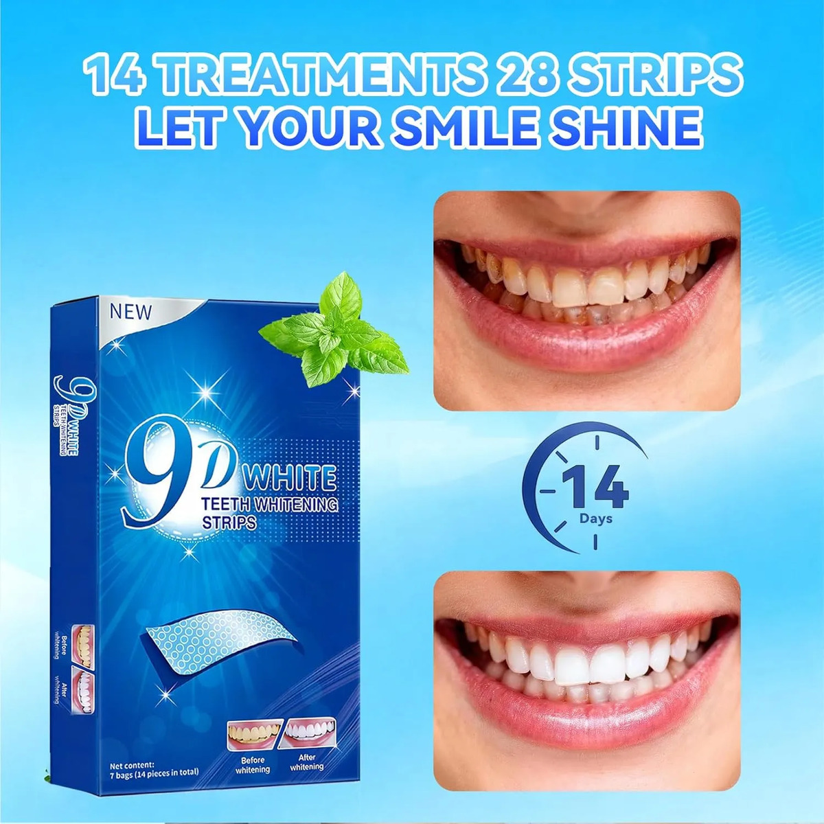 치아 미백 스트립 - 9D 치아 미백 키트 전문가 효과 - Teeth Whitening Effects 리뷰 및 가격