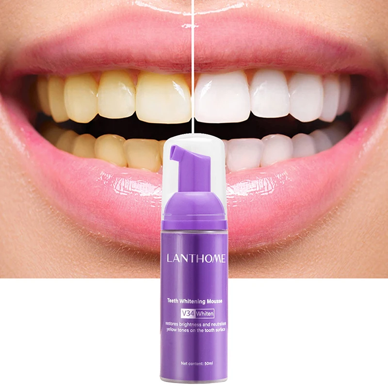 무스 V34 치아 세척 효과적인 미백 치약, 치아 얼룩 - Teeth Whitening Crest 리뷰 및 가격