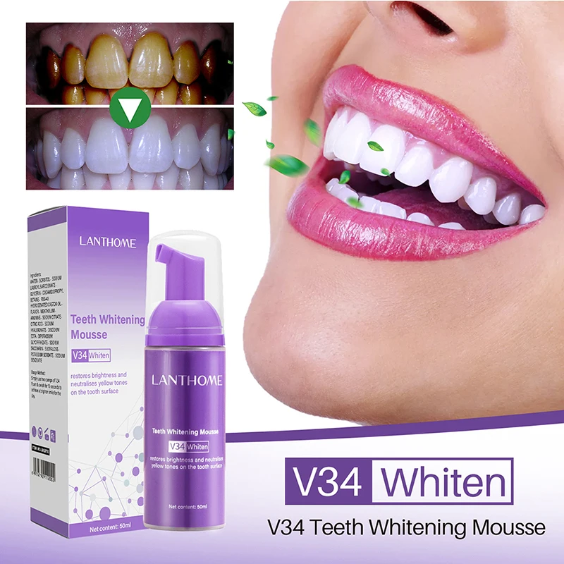 무스 V34 치아 세척 효과적인 미백 치약, 치아 얼룩 - Teeth Whitening Crest 리뷰 및 가격